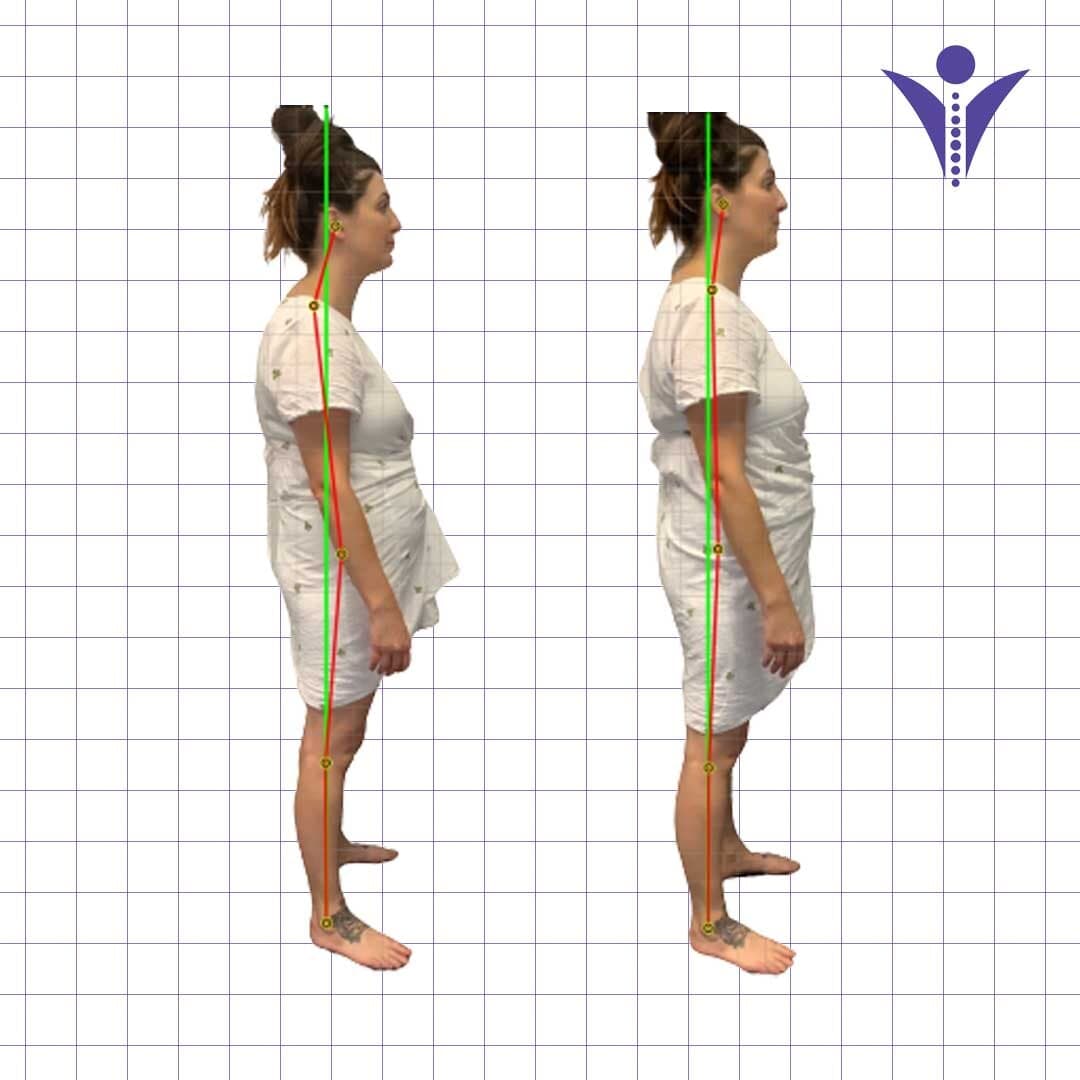 Charlotte's side-view posture photographs from two visits, on a measuring grid.
