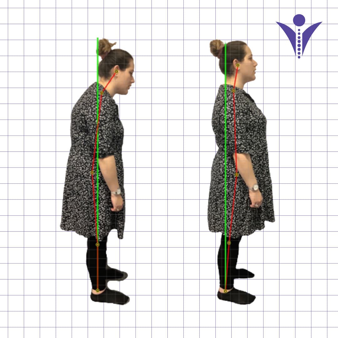 Gila's side-view posture photographs from two visits, on a measuring grid.