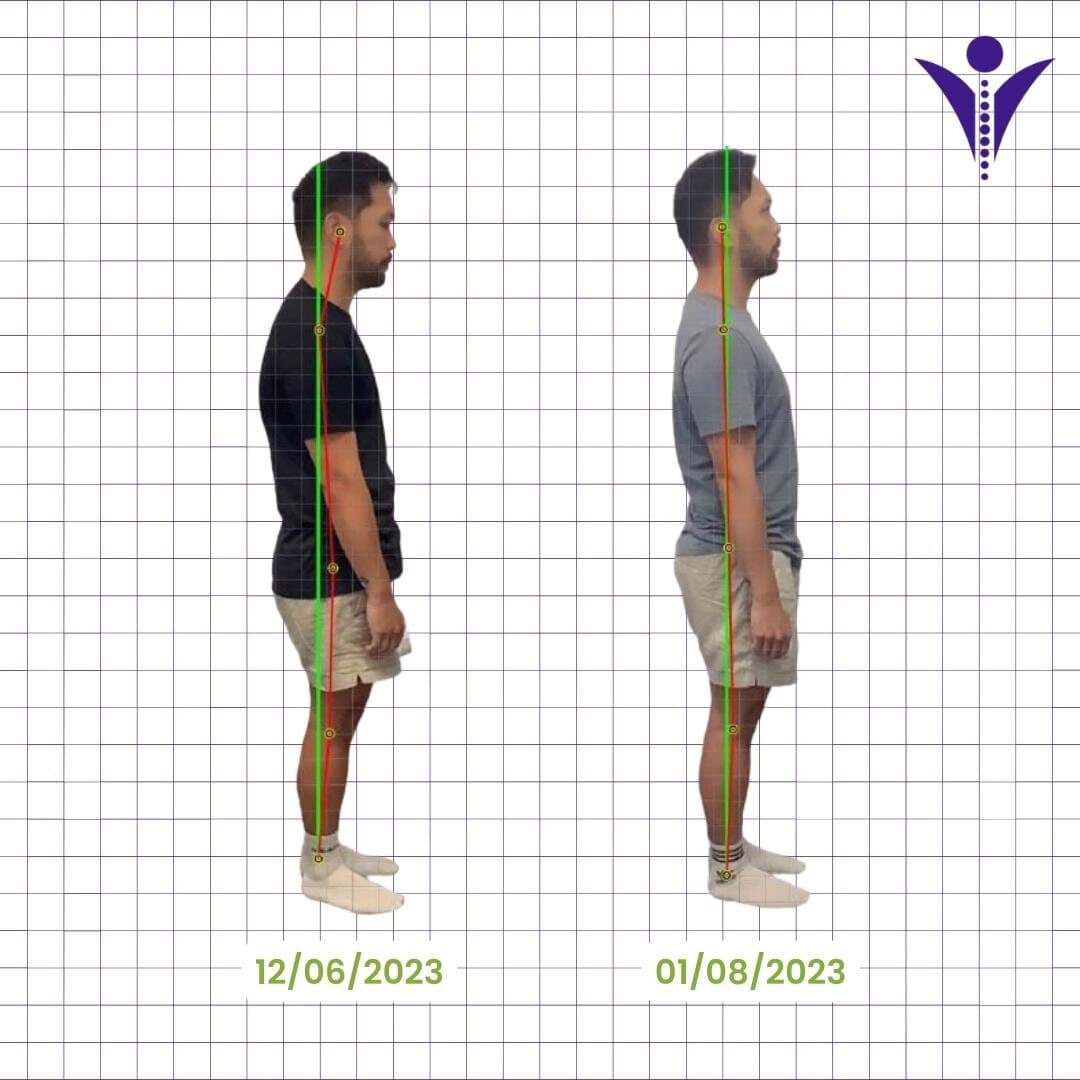Rogie's side-view posture photographs from two visits, on a measuring grid.